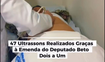 Mutirão de Saúde: 47 Ultrassons Realizados graças à Emenda do Deputado Beto Dois a Um